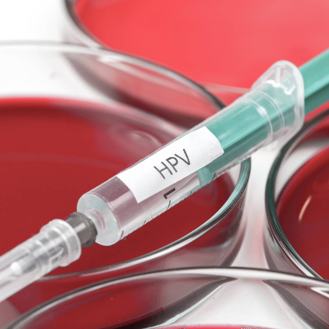HPV Testim Pozitif Çıktı Ne Yapmam Lazım? 